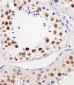 TERF2IP Antibody